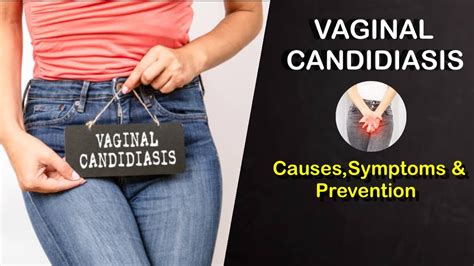 Vaginal Candidiasis Itching In Private Part Dr Poonam Maggo Youtube