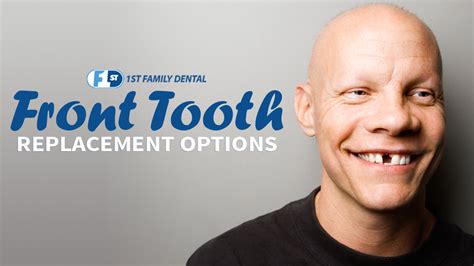 If you have recently been hit in the mouth and notice a tooth or two has become loose then you should see your dentist immediately. Front Tooth Replacement Options | 1st Family Dental