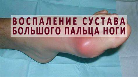 Упражнения на ноги чтобы похудели ляшки