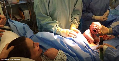 Viral Video Shows Woman Giving Birth Via Natural Caesarean Daily