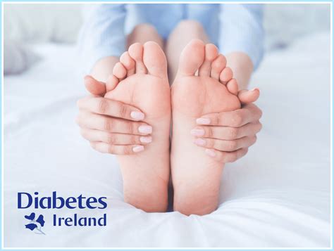 Caring For Your Feet Diabetes Ireland Diabetes Ireland