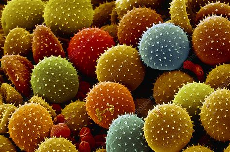 Rust Fungus Spores Sem Stock Image B2750036 Science Photo Library