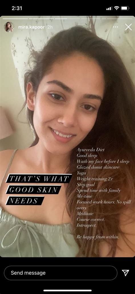 Mira Rajput S Latest Look With Swollen Lips Cheekbones Might Not Get Fans Approval Check Out