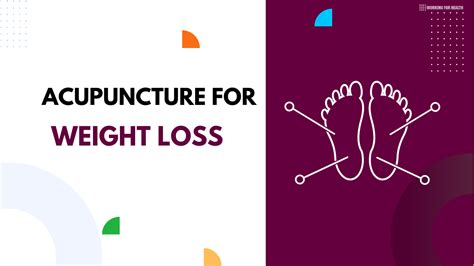 acupuncture for weight loss benefits side effects and more working for health