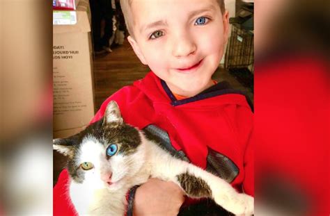 Boy Bullied For His Two Different Colored Eyes And Cleft