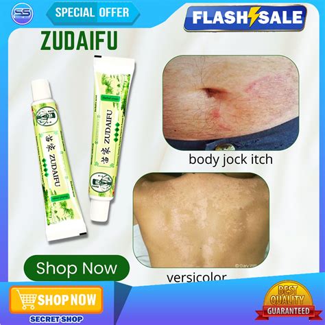 original 15g zudaifu natural chinese herb herbal medicine psoriasis eczema ointment dermatitis