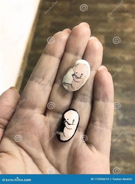 Embryo In Woman Hand 8 Weeks Human Embryo Stock Photo Image Of