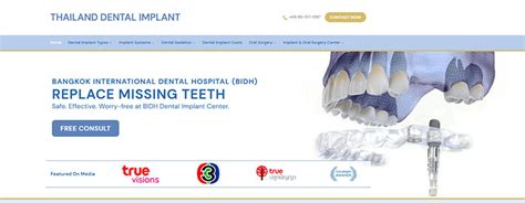 Exploring The Popularity Of Dental Implants In Thailand