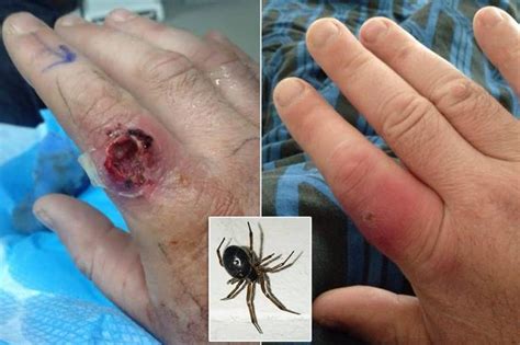 False Widow Spiders Latest News Updates Pictures Video Reaction The Mirror