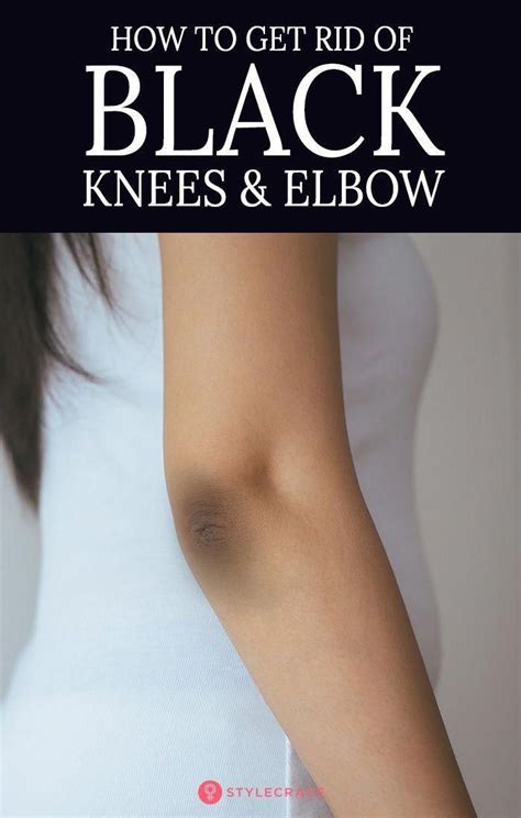 14 Home Remedies To Get Rid Of Black Knees And Elbow Beauty Tips For