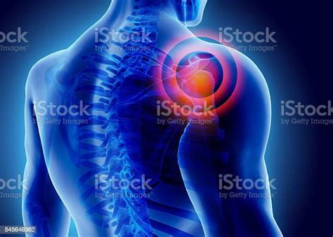 3d Illustration Of Shoulder Painful Stock Photo Download Image Now