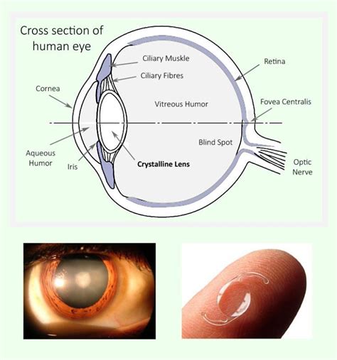 Schematic Cross Section Of The Human Eye Top And Exemplary Images Of
