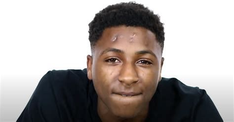 What Happened To Nba Youngboys Head Heres How The Rapper Got Those Scars