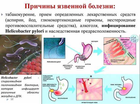 Острый гастрит диеты Острый гастрит у детей: симптомы, лечение, диета и принципы питания Острый гастрит у детей: симптомы, лечение, диета и принципы питания Острый гастрит диеты
