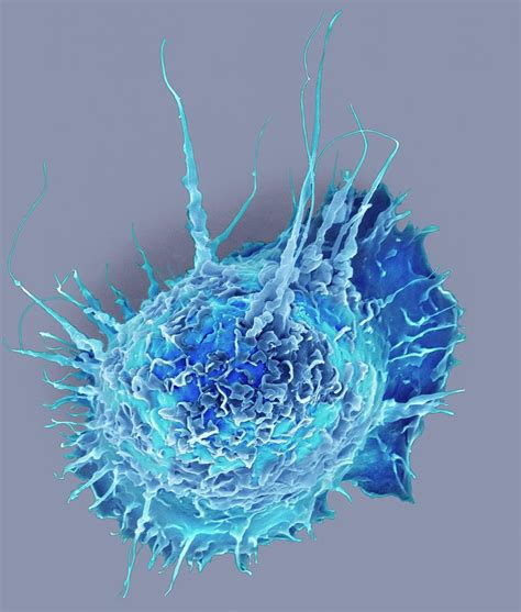 Alveolar Macrophage Photograph By Dennis Kunkel Microscopyscience