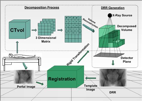 Process Work Flow Of 2d 3d Registration Using Decomposed Compressed Ct