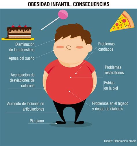 Obesidad Infantil En Cuba Un Problema En Aumento Sitio Oficial De