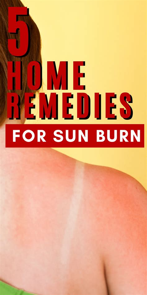 7 Home Remedies For Sunburn Midwest Modern Momma