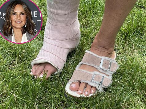 Celebrity Injuries Through The Years Photos