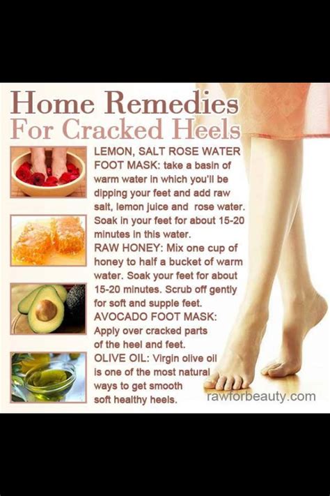 Home Remedies For Cracked Heels Musely