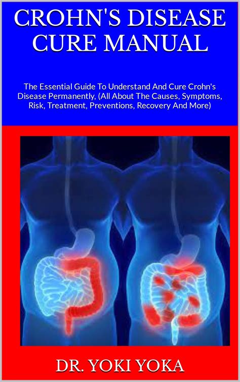 Crohn S Disease Cure Manual The Essential Guide To Understand And Cure