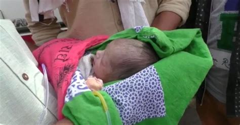 Baby Girl Born With Heart Pumping Outside Chest Waits For Life Saving