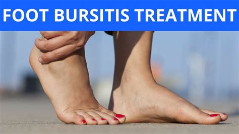 Foot Bursitis Treatment Youtube