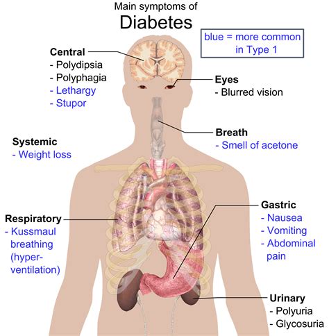 Symptoms sometimes occur after a viral illness. File:Main symptoms of diabetes.png - Wikimedia Commons