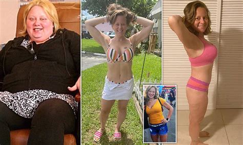 Fast Food Addict Sheds An Incredible 164lbs With Help Of A Gastric Sleeve Daily Mail Online