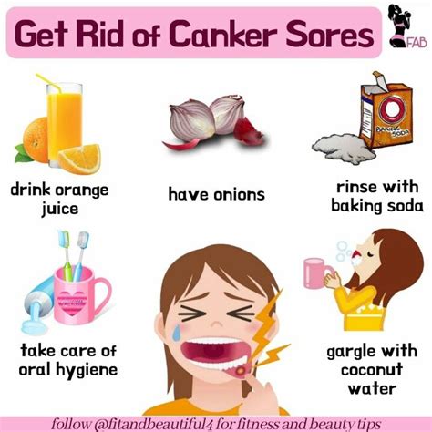 Foods That Cause Canker Sores Foodnamc