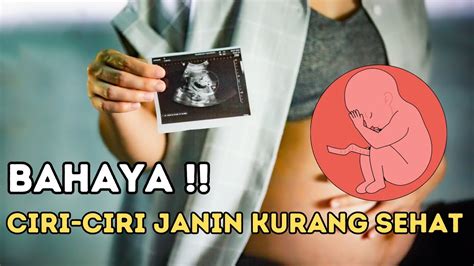 Tanda Janin Tidak Sehat Dalam Kandungan Youtube