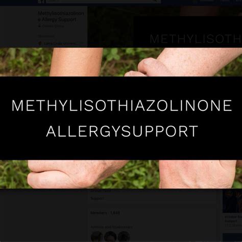 Methylisothiazolinone Allergy Support Dermatitis Academy
