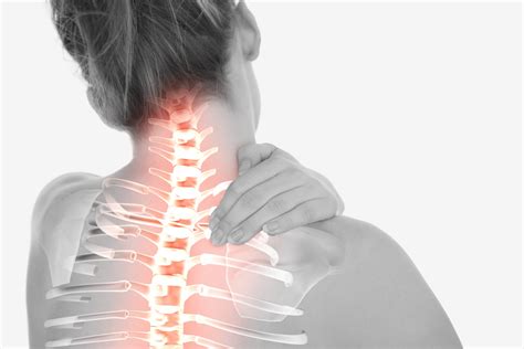 Neck Pain Barry Goldman Physical Therapy