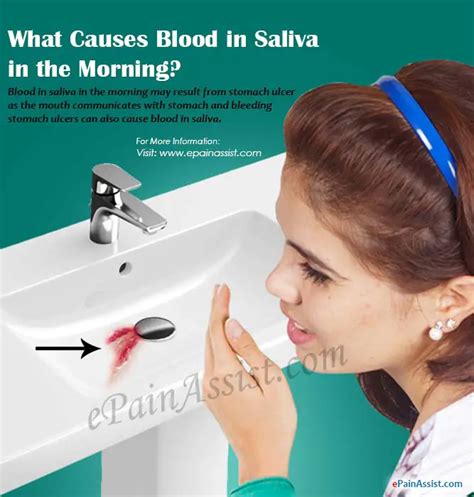 What Causes Blood In Saliva In The Morning
