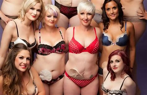 Crohns Disease Sufferers Strip Off For Raunchy Lingerie Calendar To Prove Stoma Bags Can Be