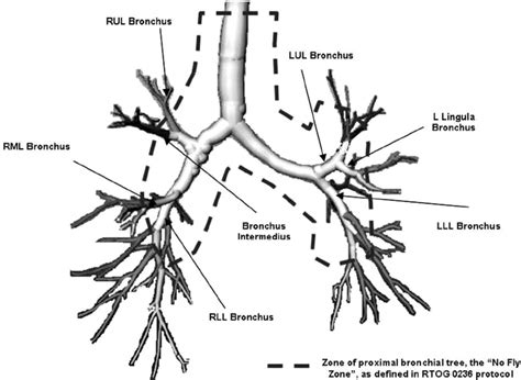 Bronchial Tree Demonstrating Central Exclusion Zone Where Stereotactic