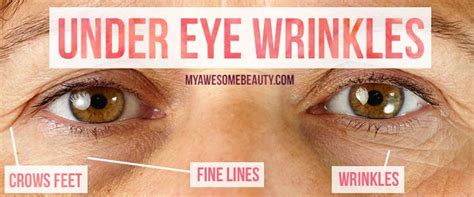 When you move a snap into my eyes only, you can feel free to let someone else browse your memories section, without worrying about them seeing content that you want to keep private. How to get rid of under eye wrinkles fast and safely