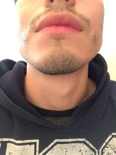 Of ground cinnamon powder with 2tsp. 1 week into minoxidil, my goal is to grow facial hair on ...