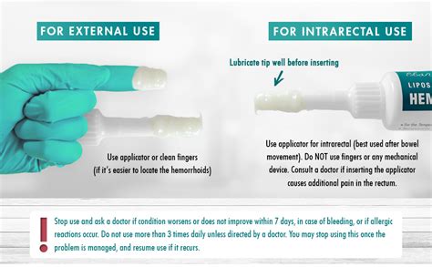 ebanel hemorrhoid treatment ointment 1 6 oz lidocaine anal fissure anesthetic cream