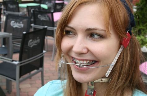 Braces Girlswithbraces Metalbraces Headgear Cute Braces Braces