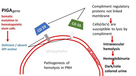 As nouns the difference between lyonization and lionization. Pathology of PAROXYSMAL NOCTURNAL HEMOGLOBINURIA ...