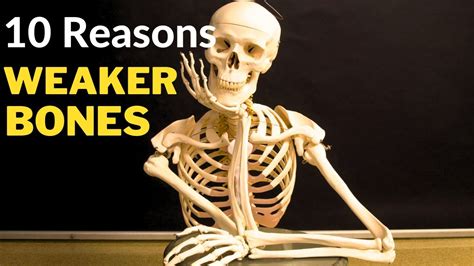 10 Basic Reasons Of Weak Bones Youtube