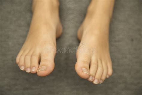 Foot Stock Photo Image Of Cellulite Closeup Care 101991854