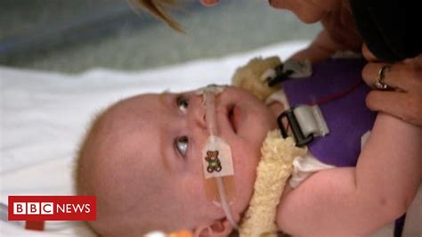 Baby Born With Heart Outside Body Set To Return Home Heart Saver