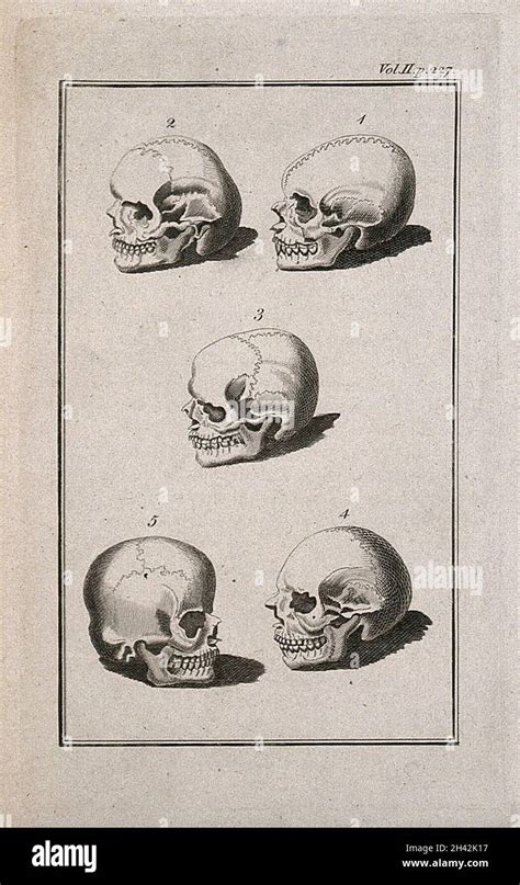 Human Skulls Showing Sutures Five Figures Line Engraving 17801800