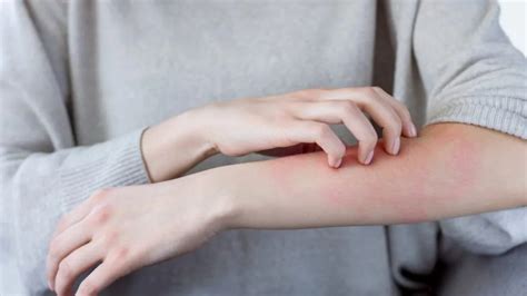 What Causes An Autoimmune Rash And The Next Steps To Take