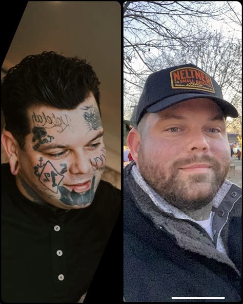 Home - Tattoo Removal Ink