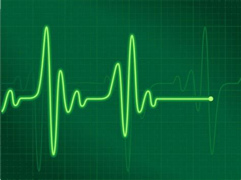 What is an irregular heartbeat? Heartbeat Irregularity a Common Condition With Potential ...