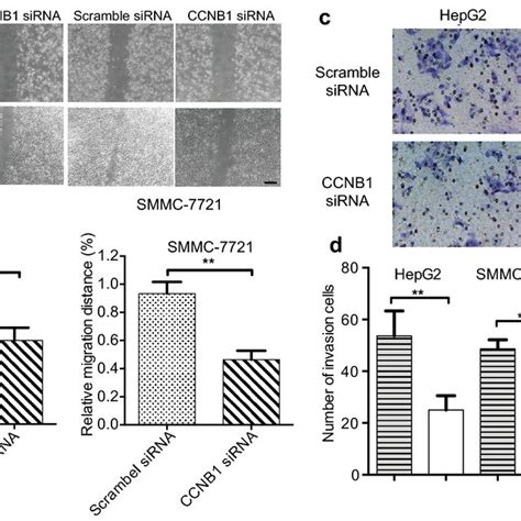 ccnb1 knockdown inhibits hcc cell migration and invasion a hepg2 and download scientific