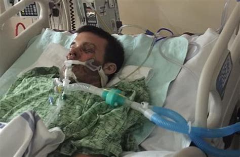 Man In Coma After E Cigarette Explodes In Face